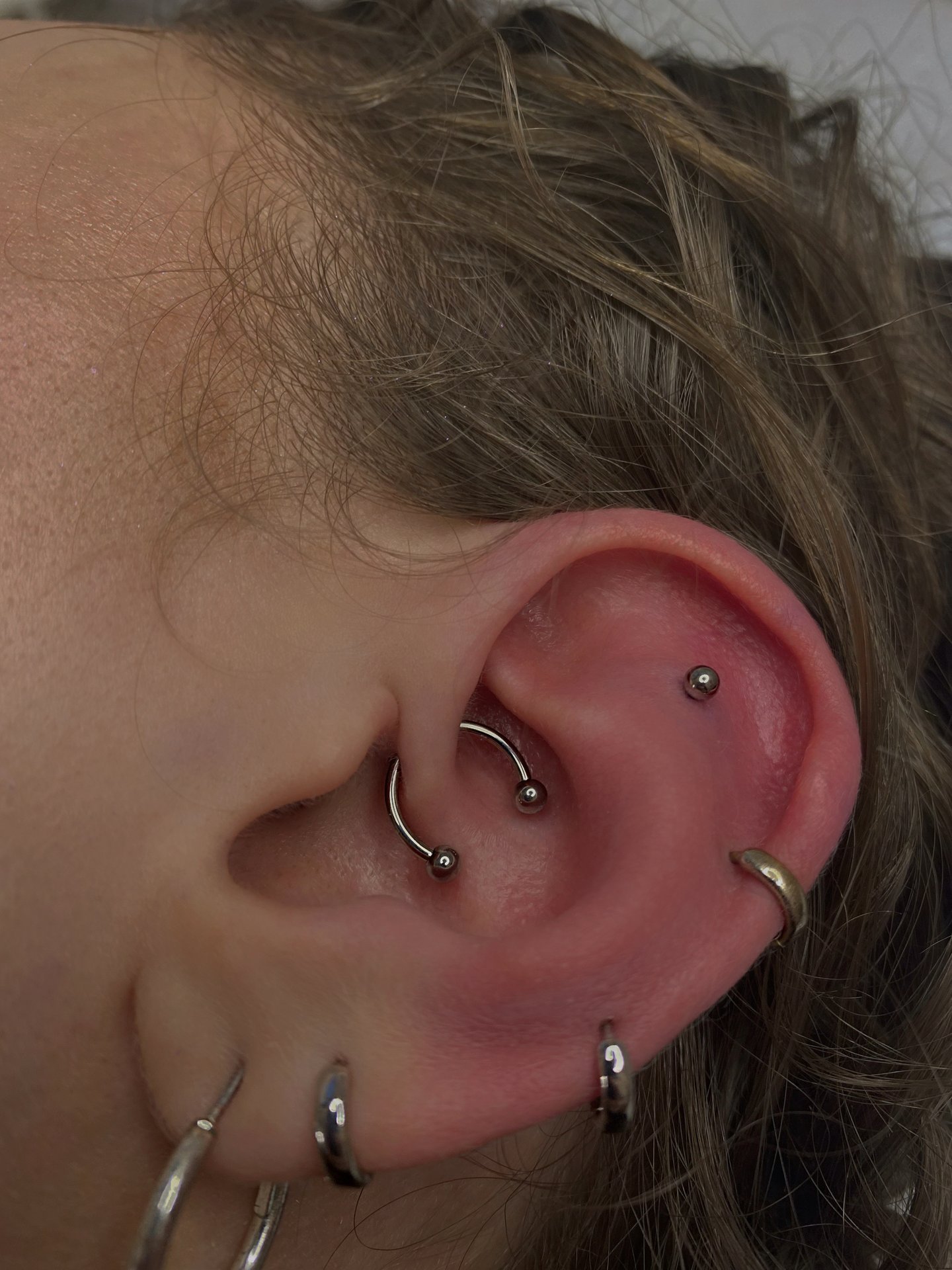 Kolczyk daith z tytanu chirurgicznego ASTM F136 - model 03