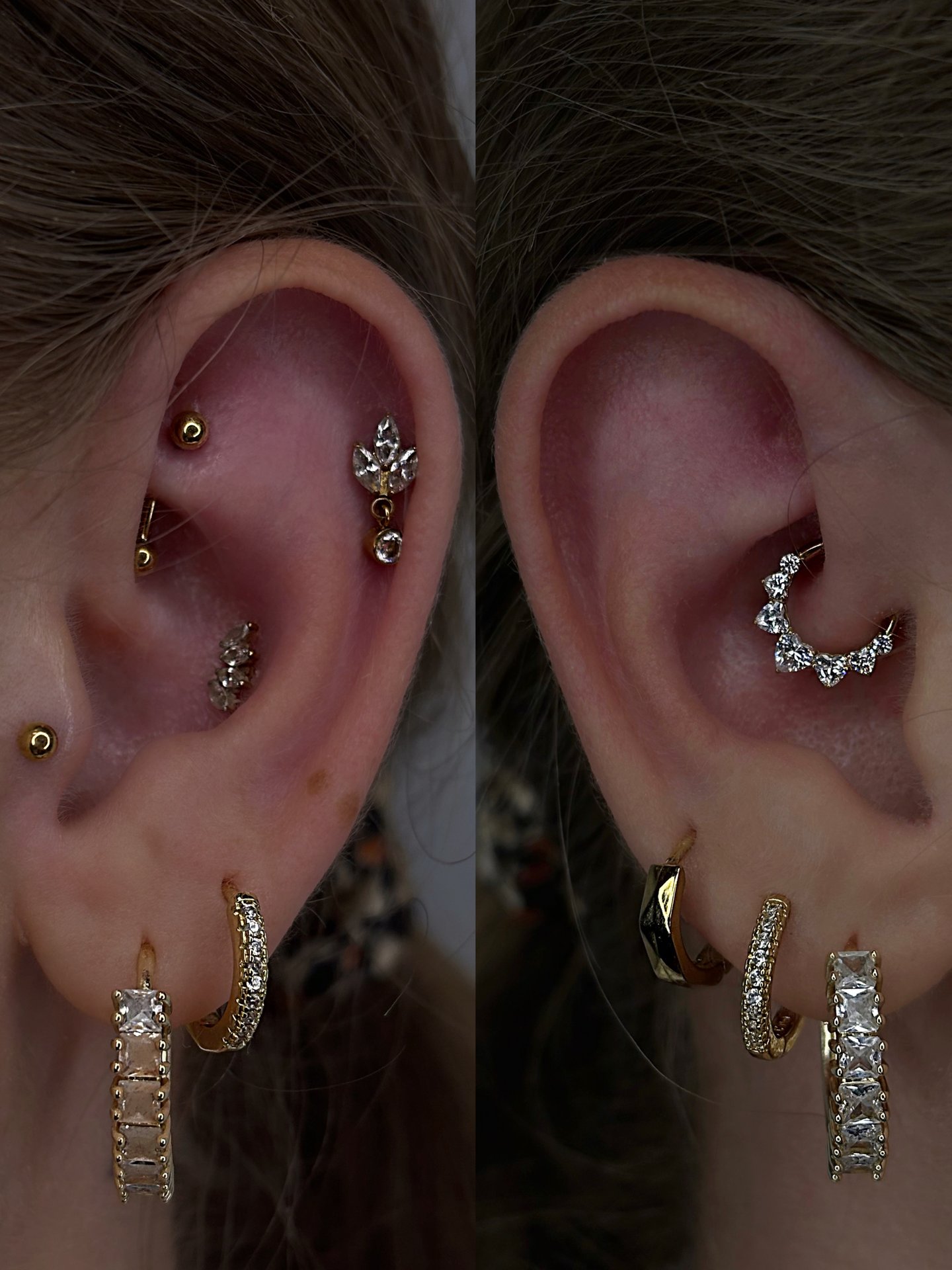 Kolczyk daith z tytanu chirurgicznego ASTM F136 - model 05