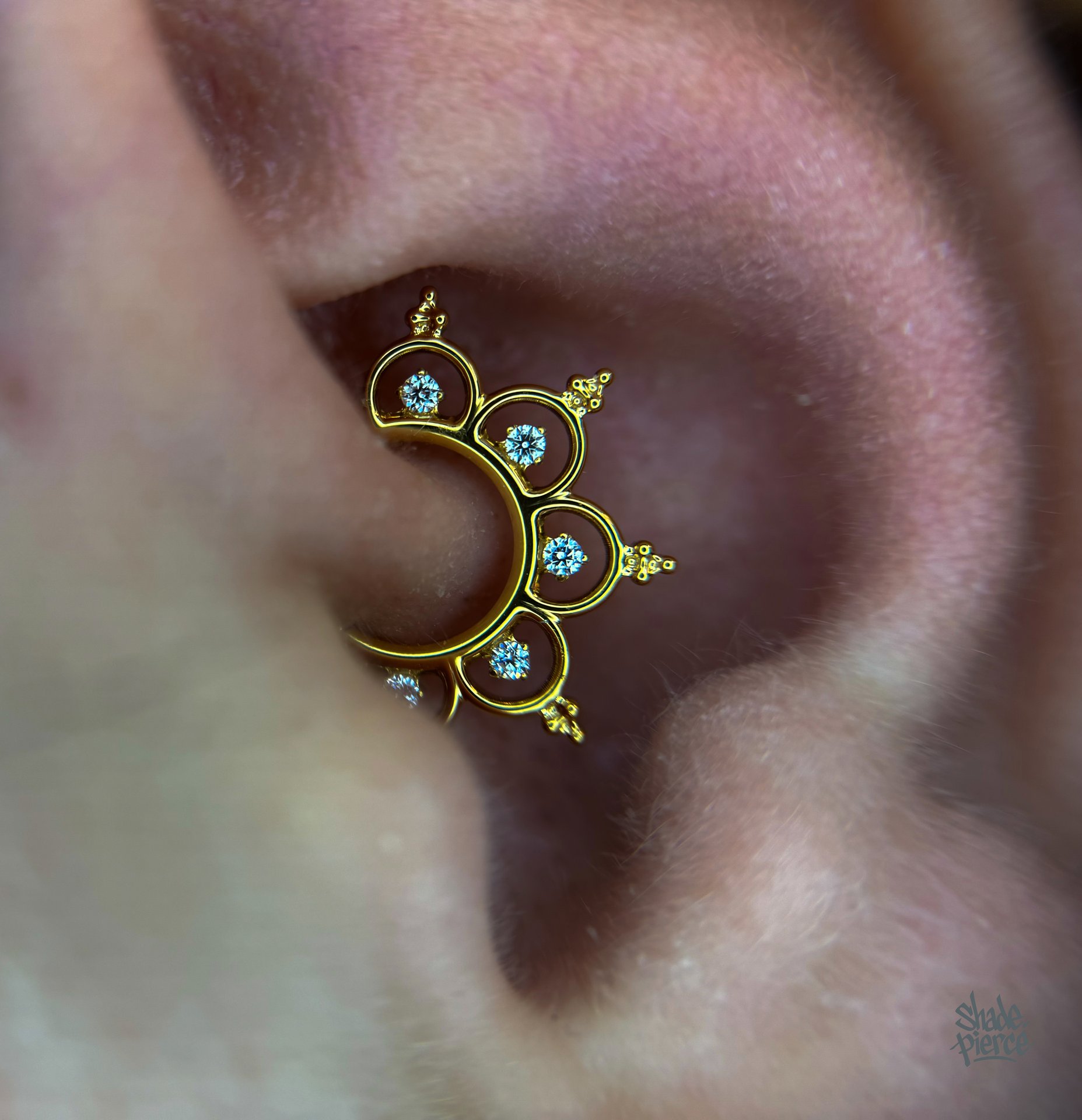 Kolczyk daith z tytanu chirurgicznego ASTM F136 - model 06
